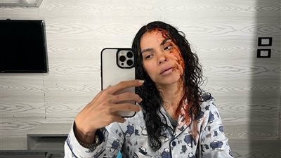 هايدي خالد: 