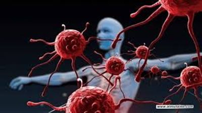 علماء بريطانيون يطورون عقار لعلاج نوع مميت من السرطان