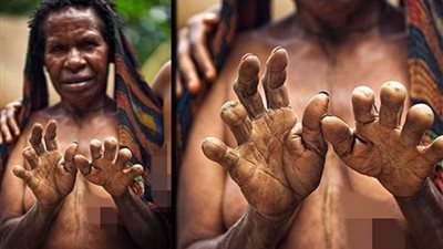 قطع أصابع النساء وحرقها جانب الميت .. أغرب العادات والتقاليد الإندونيسية 