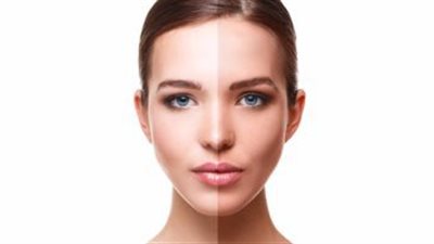 وصفات طبيعية لحماية البشرة من آثار الشمس الضارة.. تعرف عليها