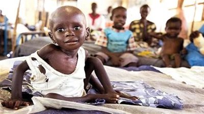 كارثة إنسانية وحرباً دامية.. سوء التغذية يفتك بـ أطفال السودان