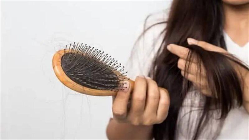 تساقط الشعر