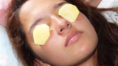 فعالية البطاطا في علاج الهالات السوداء: خرافة أم حقيقة علمية؟