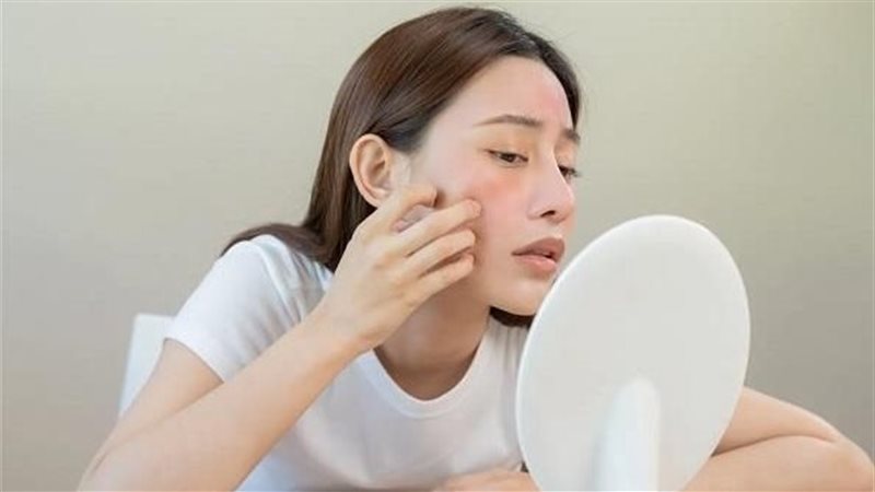 علامات ارتفاع الكوليسترول