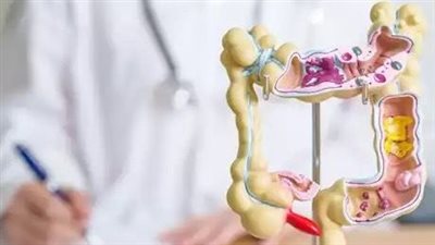 ودّع آلام القولون في 30 يومًا مع هذا النظام الغذائي المتكامل