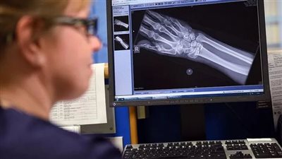 21 غذاءً طبيعياً غنياً بالكالسيوم للحفاظ على صحة العظام والتصدي لهشاشتها