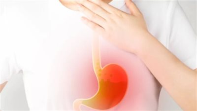 تعاني من ارتجاع المريء؟ أهم النصائح والمحاذير لحياة أفضل بدون معاناة