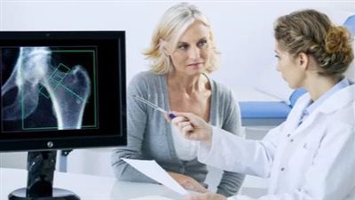 لأنهن أكثر عرضة لهشاشة العظام: استشاري تغذية يوصي السيدات بهذه الأطعمة الضرورية