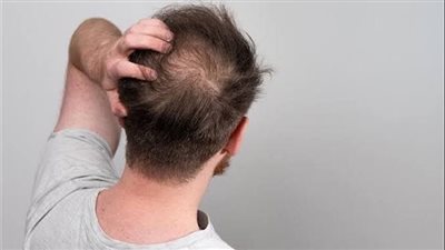 أنقذ شعرك قبل فوات الأوان.. عادة تضر الشعر وتؤدي إلى الصلع