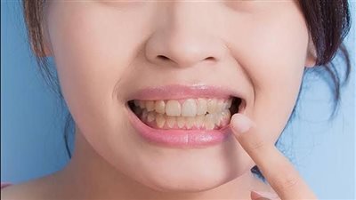 مشروبات تؤدي إلى تصبغات الأسنان.. تعرف عليها