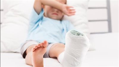 كسر الركبة عند الأطفال: الأعراض الرئيسية وطرق التشخيص والعلاج الفعّالة