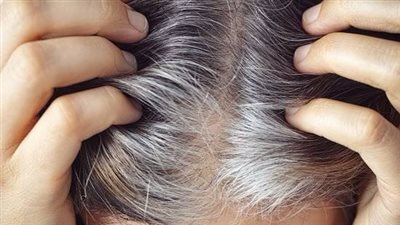 وداعًا لشيب الشعر المبكر.. وصفات طبيعية فعالة لاستعادة لونه الأصلي