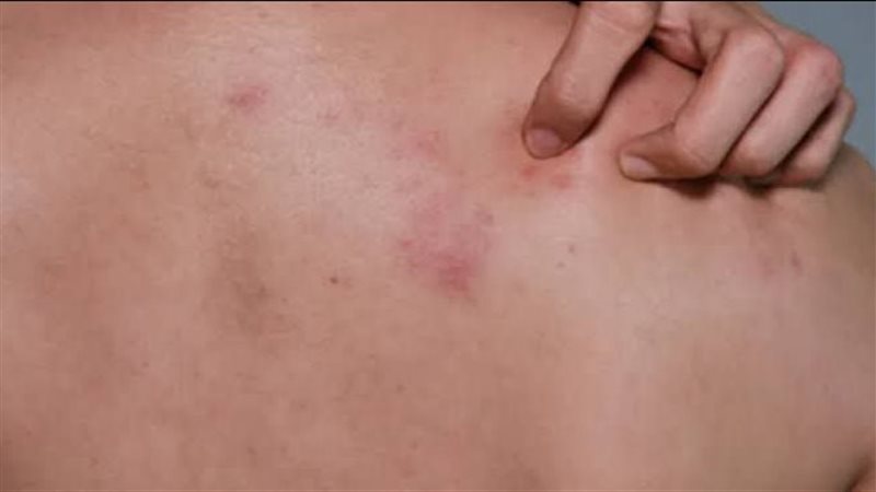 الحزام الناري