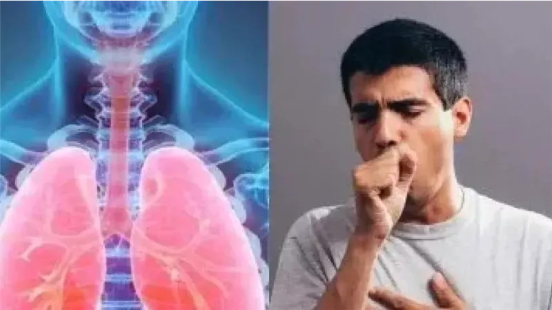 مرضى الجهاز التنفسي