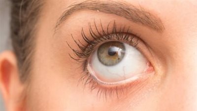 أسباب «جفاف العين» وأبرز الأعراض التي لا يجب تجاهلها 