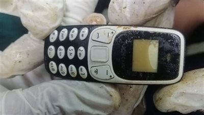 «المعدة تستقبل المكالمات».. مريض يحتفظ بهاتف داخل جسده لعامين وفريق طبي ينقذة