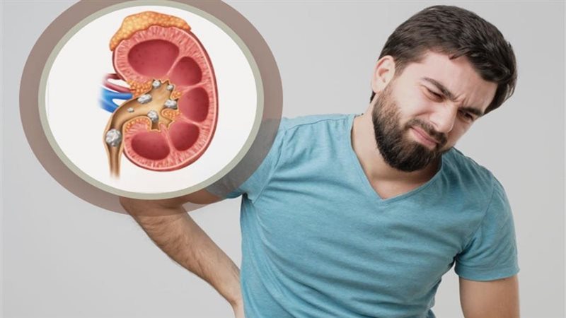 أمراض الكلى