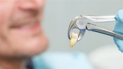 نصائح مهمة «بعد خلع الضرس».. هكذا تتجنب الألم والالتهاب