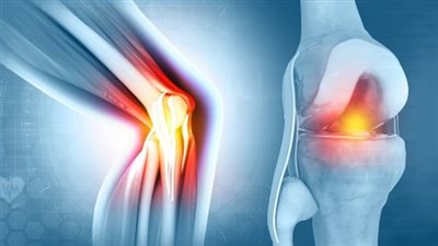 لا تتجاهل الأعراض .. تعرف على أسباب «آلام الركبة» أثناء المشي والصعود