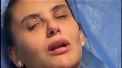 بعد الحقن الكارثي.. دانا حمدان تكشف معاناتها مع التشوهات الوجهية