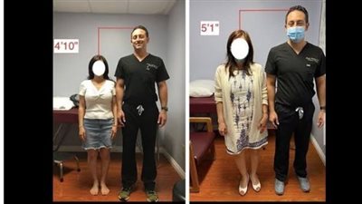 موضة غريبة تجتاح تركيا.. عمليات «قص العظام» لتقصير القامة بين النساء 