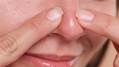 وصفات طبيعية للوجه لإزالة «الجلد الميت» و«الرؤوس البيضاء» 