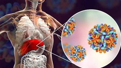 أبرز مؤشرات الإصابة بفيروس «الكبد الوبائي B»