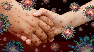«فيروس HFMD» عند الكبار.. أسئلة وأجوبة شائعة ومهمة