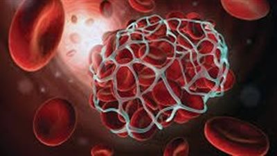 3 بدائل طبيعية لأدوية السيولة «تمنع تجلط الدم» 