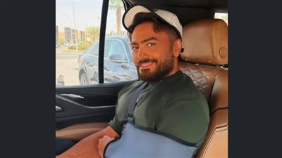 تامر حسني يكشف كواليس إصابته بعد قرار خسارة 15 كيلو