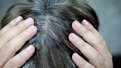وصفة طبيعية للتخلص من الشعر الأبيض بدون صبغة