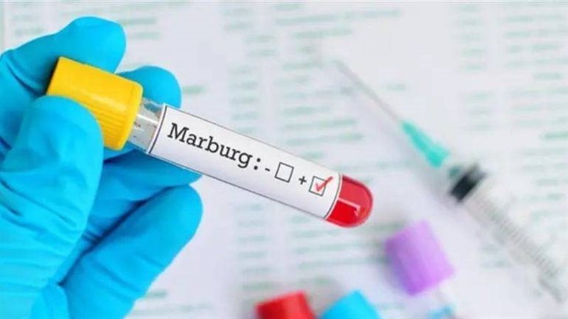 فيروس ماربورج