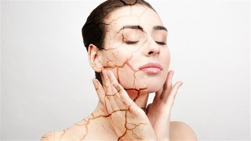جفاف البشرة 