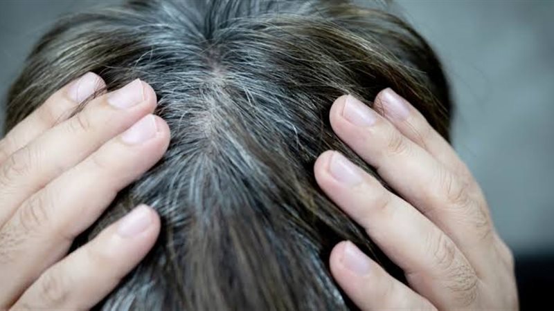 الشعر الأبيض 