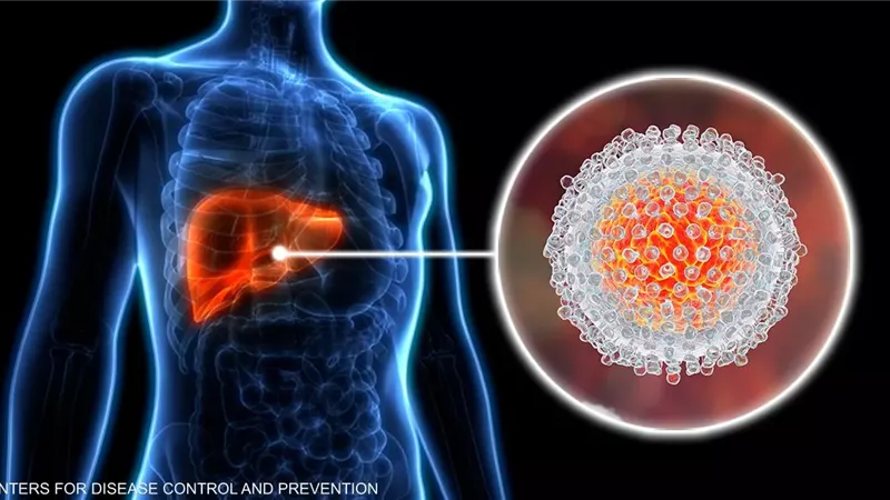 مشاكل الكبد 