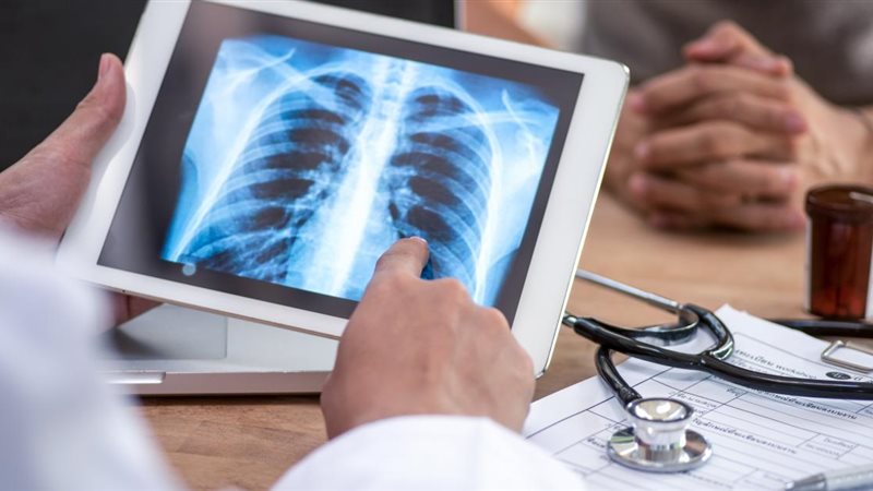 الالتهاب الرئوي الفيروسي