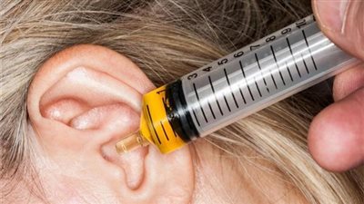 تراكم شمع الأذن.. تحذيرات مهمة لا يجب تجاهلها