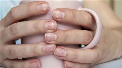احذر.. علامات الأظافر قد تشير لإصابتك بهذا المرض