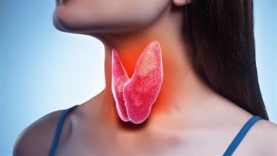 أعراض اضطراب الغدة الدرقية وطرق علاجها الطبيعية