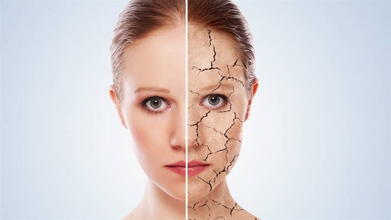 ترميم حاجز البشرة